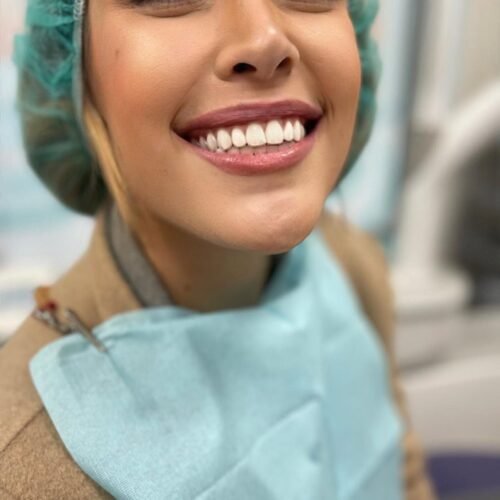 PACIENTE SONRIENTE DESPUES BLANQUEAMIENTO PACIENTE SONRIENTE DESPUES BLANQUEAMIENTO
