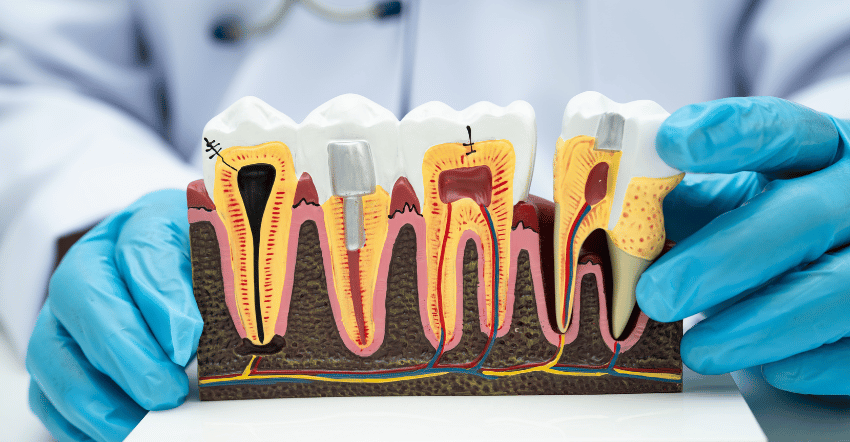Periodoncia